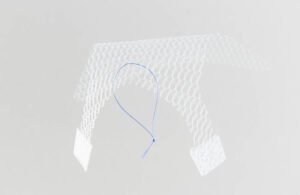 MIPS NEOPORE2